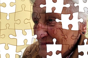 Alzheimer's disease Alzheimer's disease