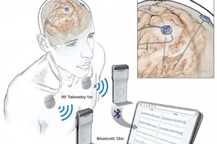 Wireless recording of brain activity